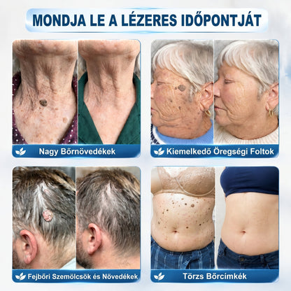 ✅✨𝐇𝐢𝐯𝐚𝐭𝐚𝐥𝐨𝐬 𝐦á𝐫𝐤𝐚𝐛𝐨𝐥𝐭  𝐏𝐢𝐜𝐝𝐨®   𝟕 𝐍𝐚𝐩𝐨𝐬 𝐁ő𝐫𝐤𝐢𝐧ö𝐯é𝐬- é𝐬 𝐅𝐨𝐥𝐭𝐫𝐚𝐝í𝐫(Fájdalommentes, nyommentes roll-on)