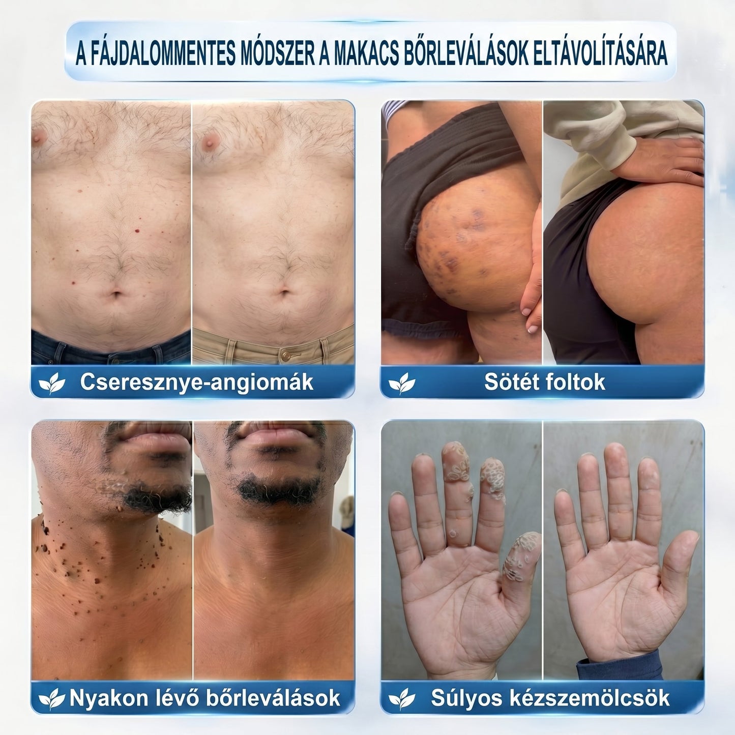 ✅✨𝐇𝐢𝐯𝐚𝐭𝐚𝐥𝐨𝐬 𝐦á𝐫𝐤𝐚𝐛𝐨𝐥𝐭  𝐏𝐢𝐜𝐝𝐨®   𝟕 𝐍𝐚𝐩𝐨𝐬 𝐁ő𝐫𝐤𝐢𝐧ö𝐯é𝐬- é𝐬 𝐅𝐨𝐥𝐭𝐫𝐚𝐝í𝐫(Fájdalommentes, nyommentes roll-on)