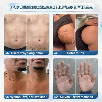 ✅✨𝐇𝐢𝐯𝐚𝐭𝐚𝐥𝐨𝐬 𝐦á𝐫𝐤𝐚𝐛𝐨𝐥𝐭  𝐏𝐢𝐜𝐝𝐨®   𝟕 𝐍𝐚𝐩𝐨𝐬 𝐁ő𝐫𝐤𝐢𝐧ö𝐯é𝐬- é𝐬 𝐅𝐨𝐥𝐭𝐫𝐚𝐝í𝐫(Fájdalommentes, nyommentes roll-on)