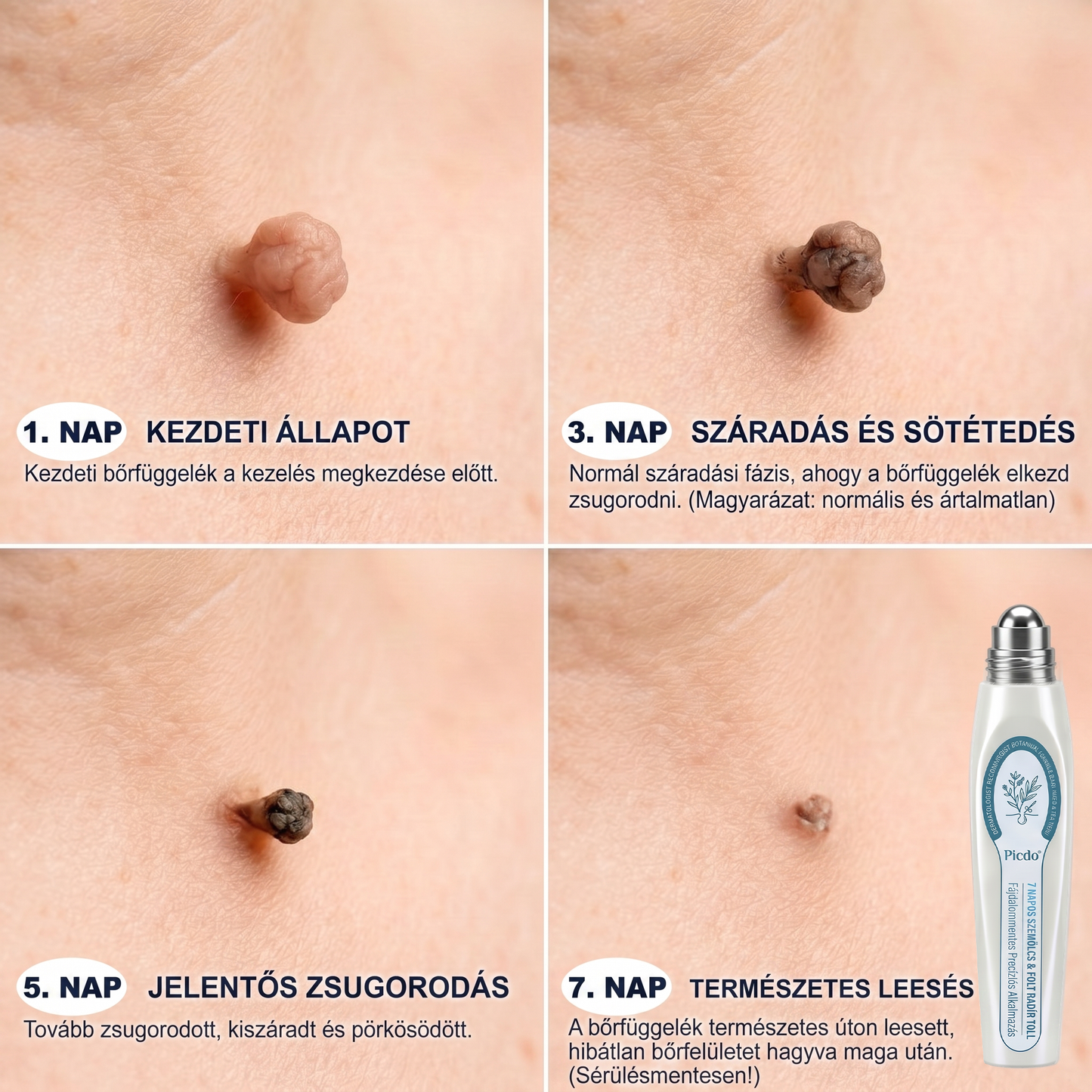 ✅✨𝐇𝐢𝐯𝐚𝐭𝐚𝐥𝐨𝐬 𝐦á𝐫𝐤𝐚𝐛𝐨𝐥𝐭  𝐏𝐢𝐜𝐝𝐨®   𝟕 𝐍𝐚𝐩𝐨𝐬 𝐁ő𝐫𝐤𝐢𝐧ö𝐯é𝐬- é𝐬 𝐅𝐨𝐥𝐭𝐫𝐚𝐝í𝐫(Fájdalommentes, nyommentes roll-on)