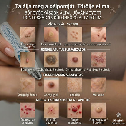 ✅✨𝐇𝐢𝐯𝐚𝐭𝐚𝐥𝐨𝐬 𝐦á𝐫𝐤𝐚𝐛𝐨𝐥𝐭  𝐏𝐢𝐜𝐝𝐨®   𝟕 𝐍𝐚𝐩𝐨𝐬 𝐁ő𝐫𝐤𝐢𝐧ö𝐯é𝐬- é𝐬 𝐅𝐨𝐥𝐭𝐫𝐚𝐝í𝐫(Fájdalommentes, nyommentes roll-on)