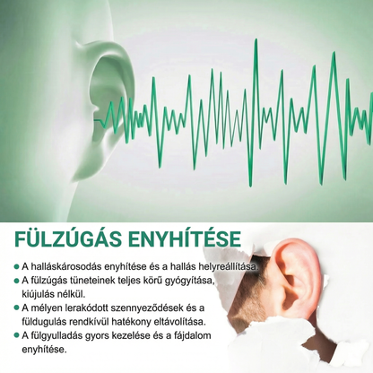 Zavrly HALLASTAMOGATOFORMULA Fülzúgás enyhítése a tiszta fülekért és a teljes kényelemért.– Azonnali enyhülést kaphat a fülzúgás és a hallási kellemetlenségek miatt.🎶